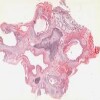 Bronchus.svs.tif thumbnail