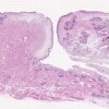 Larynx Vocal Fold_IOWA.svs.tif thumbnail