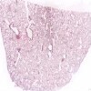 Lung1_IOWA.svs.tif thumbnail