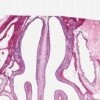 Nasal Septum_IOWA.svs.tif thumbnail