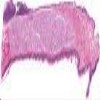 Soft Palate_IOWA.svs.tif thumbnail