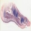 57A-34.svs.tif thumbnail