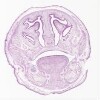 Fetal Head2 Coronal_IOWA.svs.tif thumbnail